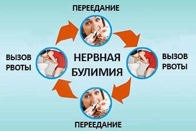 Лечение булимии в Прогрессе